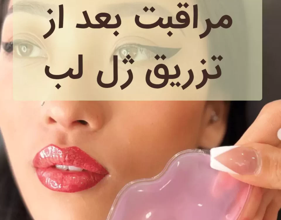 مراقبت بعد از تزریق ژل لب