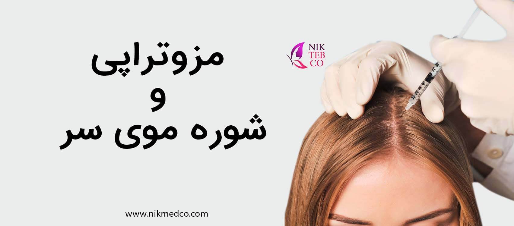 مزوتراپی شوره موی سر