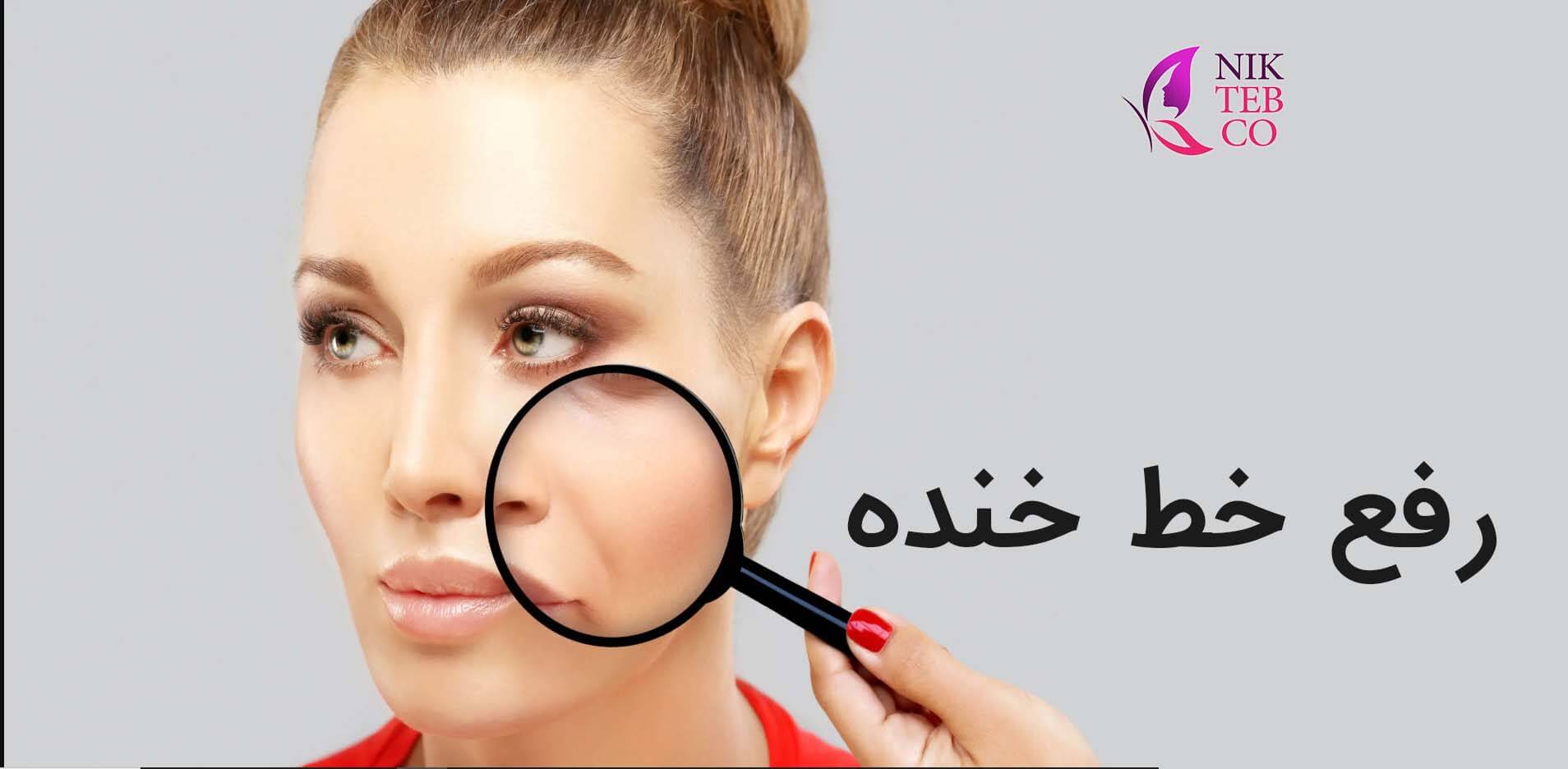 رفع خط خنده