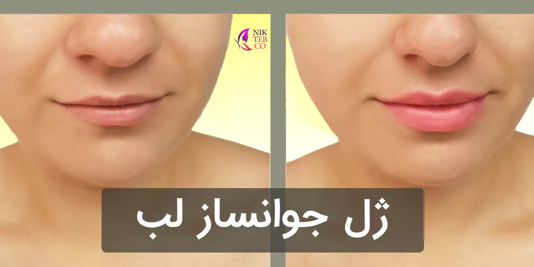 ژل جوانساز لب