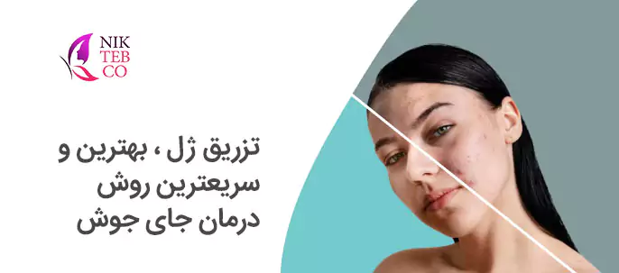 تزریق ژل ، بهترین و سریعترین روش درمان جای جوش