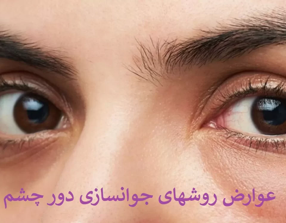 عوارض روشهای جوانسازی دور چشم